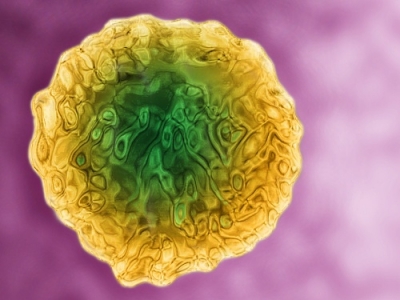 Wirusowe zapalenie wątroby