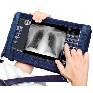 Jakie są przeciwwskazania do badania RTG?