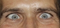 Co warto wiedzieć o zezie?